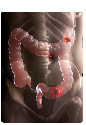 Ilustração do intestino grosso
